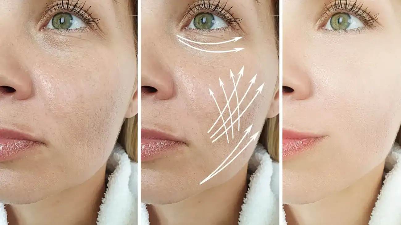 Can One Treatment Really Tackle More Than One Skin Concern Enfield?