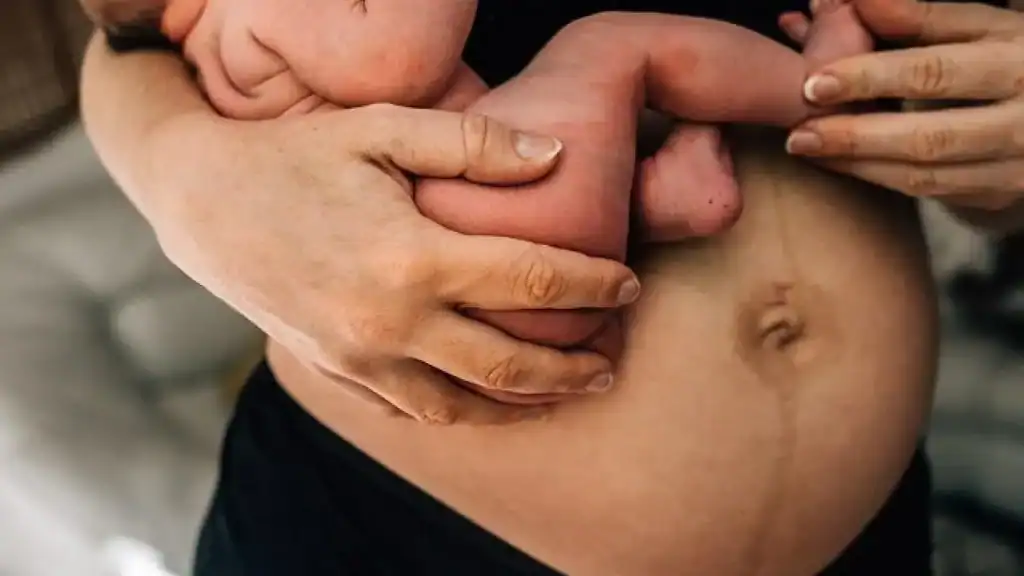 Why Is My Stomach Still Big After Pregnancy Enfield?